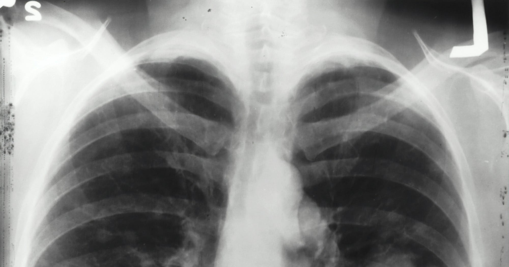 black and white abstract painting